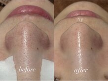 ポアレスラボ ジェンダーレスサロン 横浜/お客様ビフォーアフター