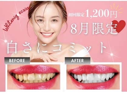 エクシアホワイトニング たまプラーザ店の写真