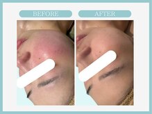 スリムライン 弘前店(The Slim Line)/before→after