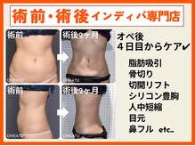 オンカツ(ONKATU)