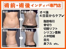 オンカツ(ONKATU)