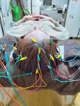 美容鍼＆首肩こり骨盤整体サロン ひふねの写真/凝り固まった頭をほぐして目元&頭の疲労を改善！肩こり・頭痛がお悩みの方おすすめ、自律神経の乱れにも◎