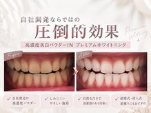 ハリト 熊本 上通り水道町(HaRi&)の雰囲気（高濃度プレミアムパウダーIN☆ホワイトニングで効果絶大！）