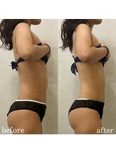 サロンドリシェス(Salon de RICHESSE)/痩身メニュー