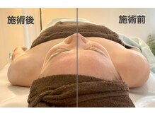 サピュイエ(S'appuyer)/巻き肩改善