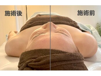 サピュイエ(S'appuyer)/巻き肩改善