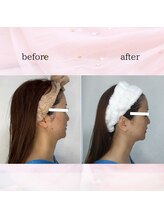 ソフィーム/エンビロンリフトフェイシャル