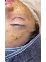 イチロクイチハチ(1618)/ #アクネケア #毛穴ケア #シミ