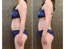 ワンルーム(1ROOM)/1回のビフォーアフター