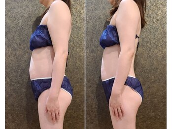 ワンルーム(1ROOM)/1回のビフォーアフター