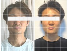 メグルサロン 自由が丘(MeguruSalon)の雰囲気（サロン独自の小顔矯正でむくみ・たるみ・シワの改善に☆）