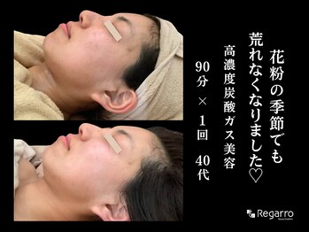 レガロビューティクリエイションズ桜川店/もう悩まない！肌荒れ改善