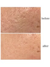 プレジール(Plaisir)/サーマトリックス