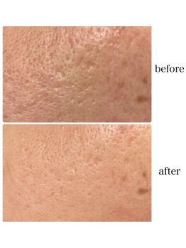 プレジール(Plaisir)/サーマトリックス