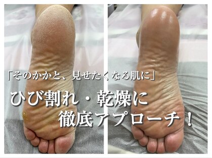 コトリ(Kotori)の写真