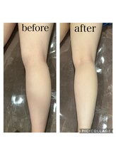 ファイブエレガンテ(5Elegante)/【施術風景】