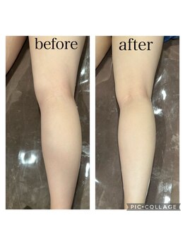 ファイブエレガンテ(5Elegante)/【施術風景】