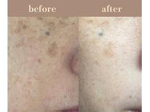 ユーアンドハニー(U&Honey.)/サロンとホームケアの相乗効果！