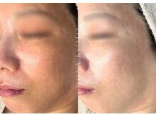 ウォナ(WONA)/【お客様症例】