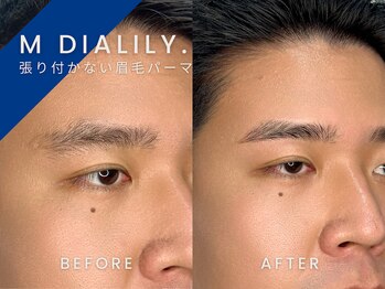 エムディアリリー(M DIALILY.)/