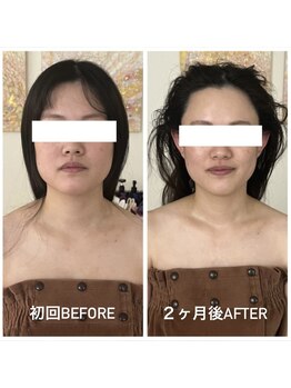 ルルボーテ(Loulou Beaute)の写真/【口コミ高評価!リピート率脅威の95%超え】頭蓋骨から調整していく本格的な造顔小顔矯正で即小顔に♪