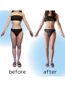 ヨサパーク リープ(YOSA PARK Leap)の写真/見た目の変化は体重より早く！痩身エステで成功体験を積み、理想の綺麗を手に入れよう☆