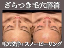【肌管理×小顔・毛穴改善フェイシャルサロン】MavY.堺駅前店【9/10 NEW OPEN(予定)】/サブスク人気MENU