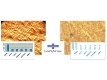 フェイシャルスタイリストサロン 高崎店(Facial Stylist Salon)/キメのケア例（4）