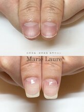 マリーロール 梅田店(Marie Laure)/深爪矯正/自爪育成/自爪風