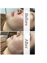 ナーススキン(nurse skin)/ビフォーアフター4