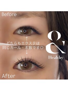 ビューティーグロウ(BEAUTY-GROW)/