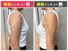 新登場【お得な術前からケア】術前後インディバモニター 60分 4回 35000円