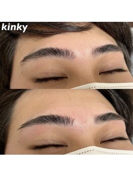 キンキー 広島(kinky)/