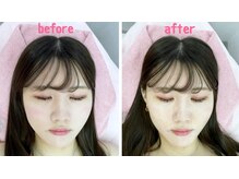 ノゾミジュク(希美熟 NOZOMIJUKU)/エイジングケア☆しわ改善