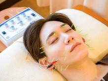 【美容鍼60分￥5000】自立神経の乱れを整えて不調を改善！