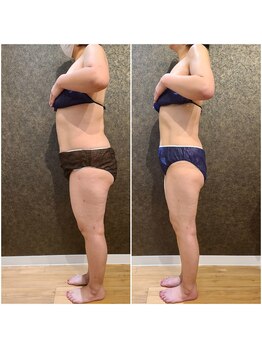 ワンルーム(1ROOM)/3ヶ月のビフォーアフター