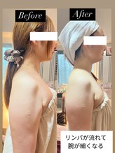 ピュアケイ(pureK)/フェイシャルコース（リンパ）