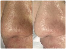 ジョルフ サロン オリジナル(JOLF salon original)/エインBefore after