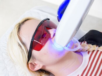 ホワイトニングカフェ 本厚木店/☆ホワイトニングLED照射