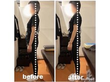 カワル整体 上通り院/反り腰の人の癖