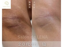 サロン ド レナ(Salon de LENA)/ハーブピーリング サロンドレナ