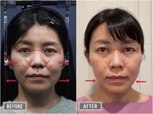 さつま骨格矯正 表参道青山院/歪み小顔矯正＋骨盤矯正