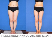 ピュアノア 垂水店/痩身ダイエット　神戸垂水明石