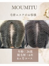ボディデザインホームクレアフェリーチェ 神戸(Body design home Crea felice)/MOUMITUスカルプ/毛密エステ