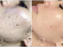 パルファンカルム 駅西本町店/これぞ、究極の美肌！