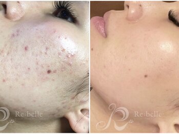 パルファンカルム 駅西本町店/これぞ、究極の美肌!