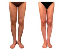 フィニシオン/50代 &nbsp;&nbsp;6ヶ月後の美脚