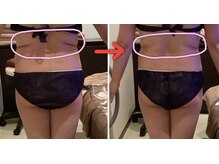 クレアボディ(CREA BODY)/背中