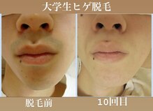 ミーシェ(Meshine)
