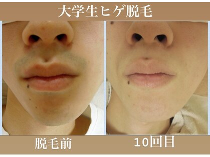 ミーシェ(Meshine)の写真